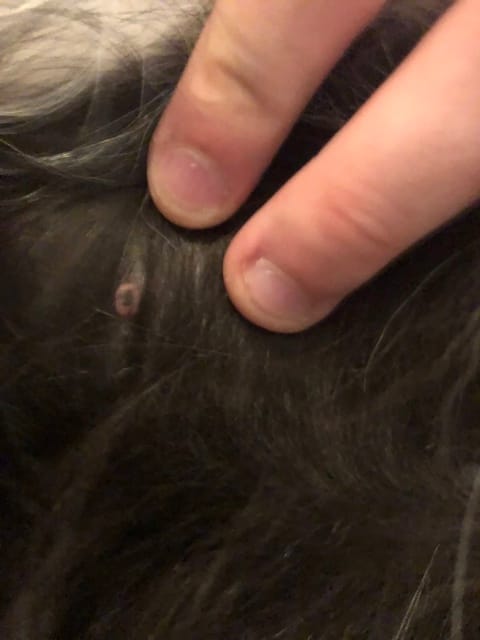 Pertes de poils et boutons au ventre
