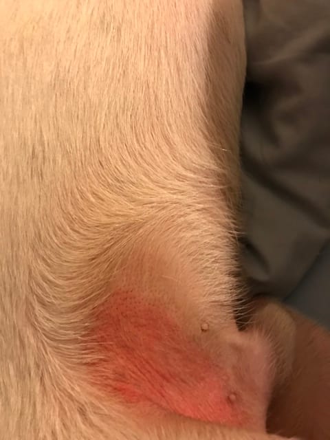 Rougeurs à l’aisne